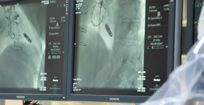 Diagnostic and Non-Invasive Cardiology